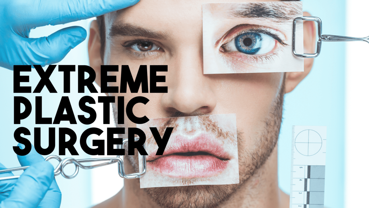 Extreme Plastic Surgery Perpetual Entertainment